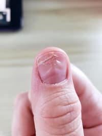 Broken Nail Help