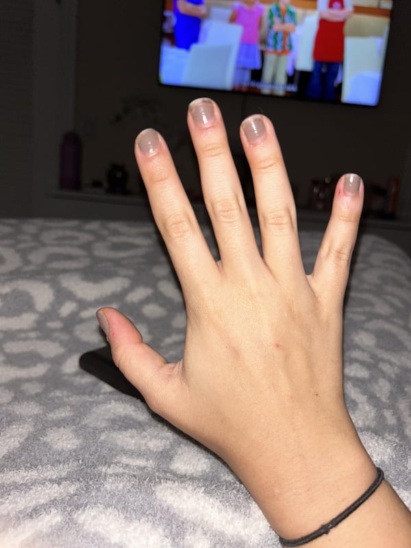 Picture by emilyylimeemily2 showing 'Best Mail Shape For Short Nail Beds?' number 2