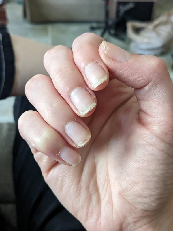 Picture by dvmbpvp saying 'Help With Nail Care? I'm A Food Service Worker But I Always Wear Gloves And I've Been Using Nail Aid's Total Cure Polish. I'm Thinking Of Starting OPI Repair Mode But Don't Want To Waste Money. Any Help?'