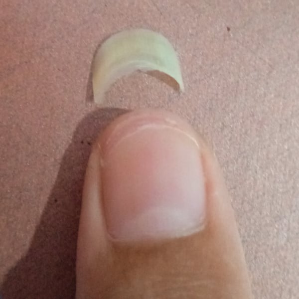 Picture by Koko_mine saying 'Just Wanna Show My Broken Thumbnail :p'