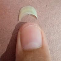 Just Wanna Show My Broken Thumbnail :p