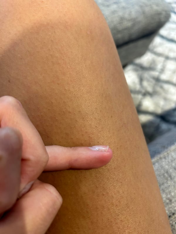 Picture by moonbabyymagic saying 'Any Idea Why My Nail Is Doing This?'