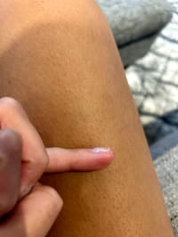 Any Idea Why My Nail Is Doing This?