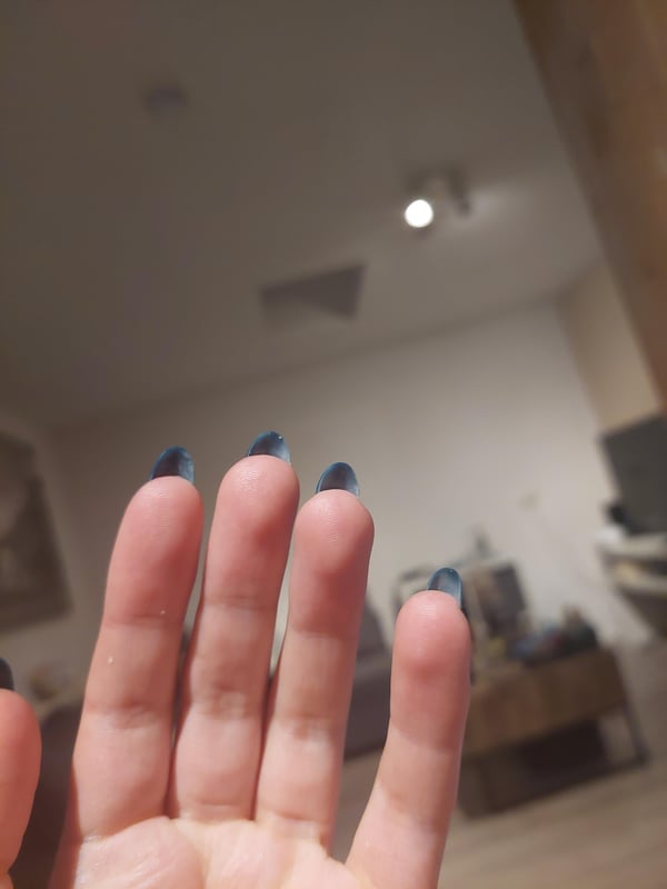 Picture by Altacc381 showing 'I Love My New Nails, But I Hate The Part Underneath! I Almost Get The Urge To Color Them As Well! Any Tips?' number 2