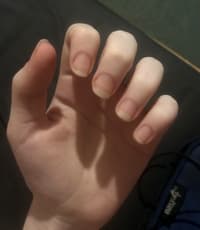 Decided To Stop Biting My Nails 4 Weeks Ago, This Is The First Time In My Life I’ve Had Them Grow This Long : Second Pic Is The Before