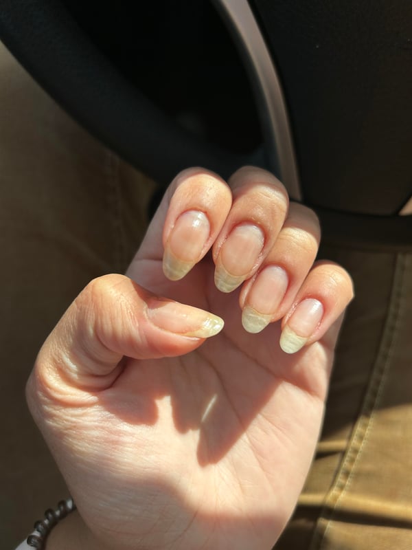 Picture by cookiepip saying 'So Proud Of My Nail Growth But Does Anyone Know How To Make Them Less Translucent Or Is That Just Genetics?'