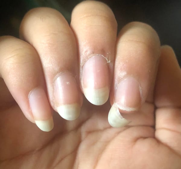 Picture by poeticbedhead saying 'When Your Nails Finally Start Growing And Then They Pull This'