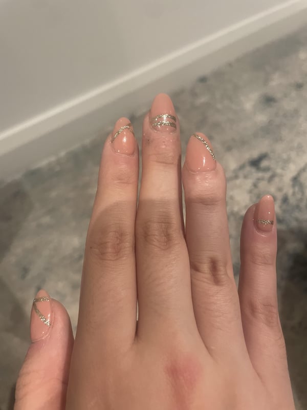 Picture by Financial-Tear-7809 saying 'I Managed To Get Acrylics Even Though I Had An Accident On A Finger/ Nail And I Am So Proud TW: Old Injury'