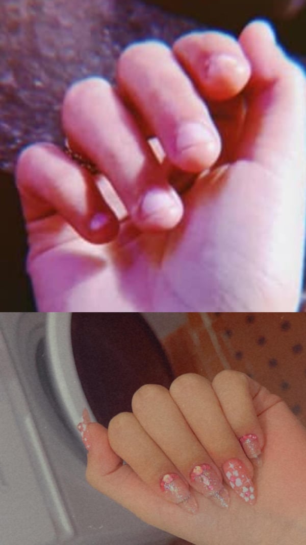 Picture by Familiar-Use4921 saying 'After 20+ Yrs Biting My Nails I Finally Stopped'