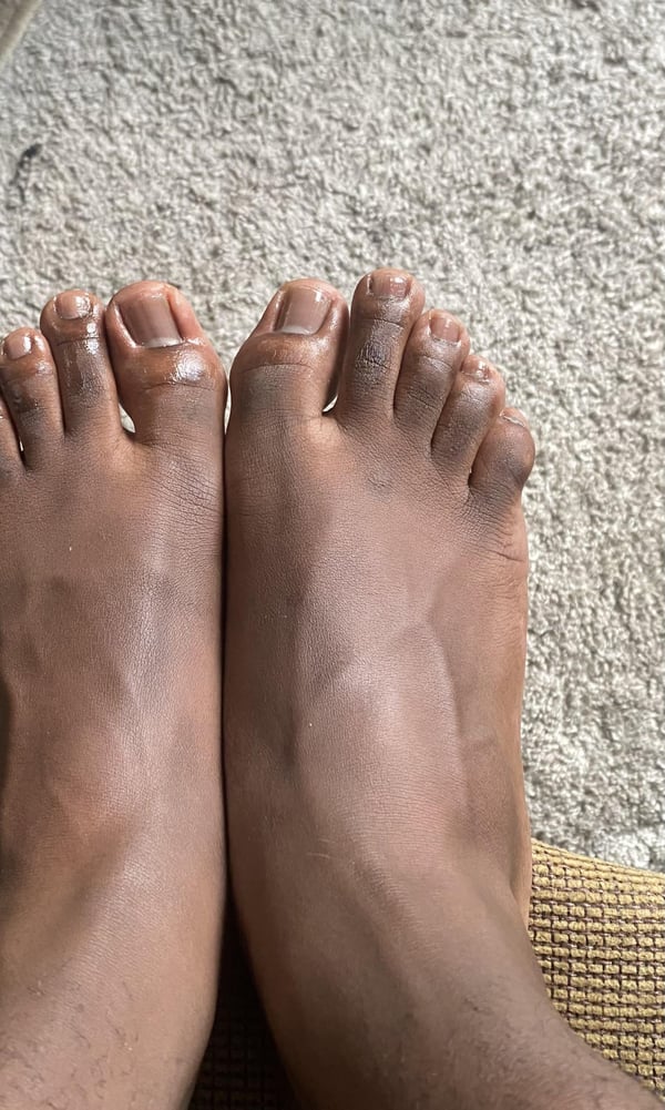 Picture by fesstooshort showing 'Manicure And Pedicure Done By Me as A Man🧍🏿‍♂️' number 2