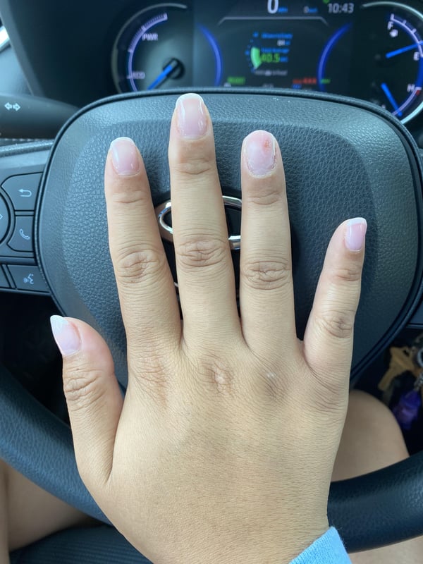 Picture by hockeycat2126 saying 'Nail Tech Drilled Into Nail Bed :'