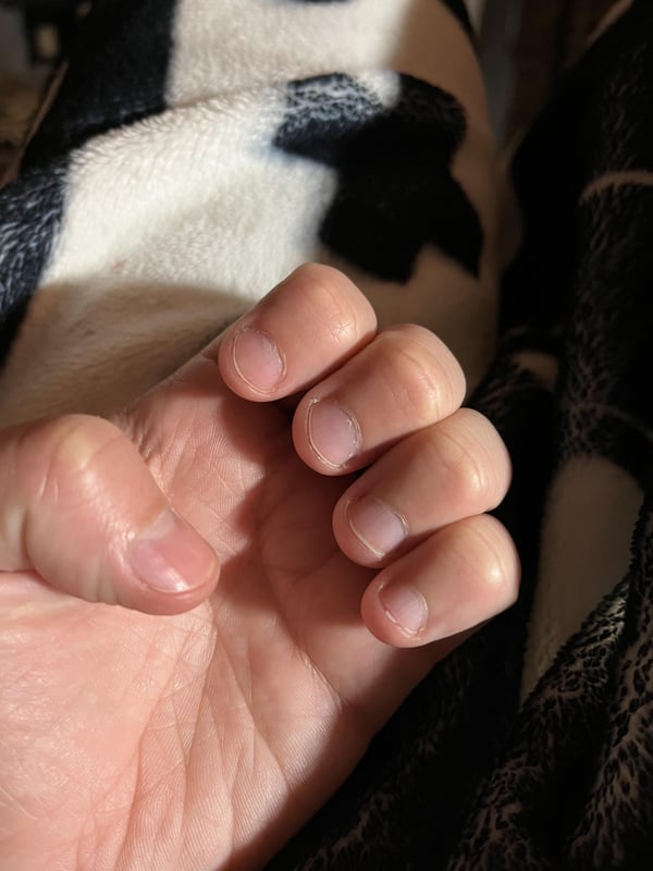 Picture by Blueberry_Fritter_ saying 'Habitual Nail Biter, Just Want Long Enough Nails For Cute Short Nails…any Suggestions For How To Overcome?'