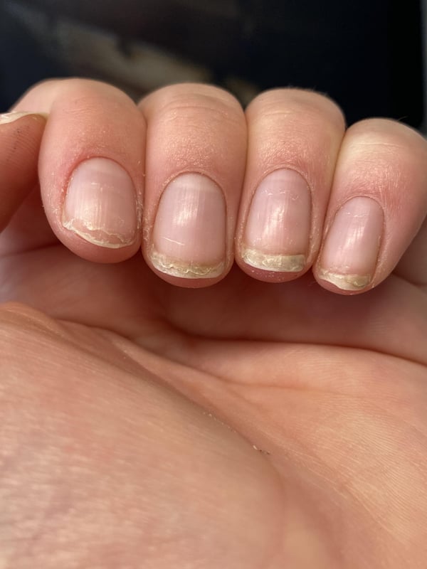 Picture by eemaymc saying 'Why Are My Nails Peeling?'