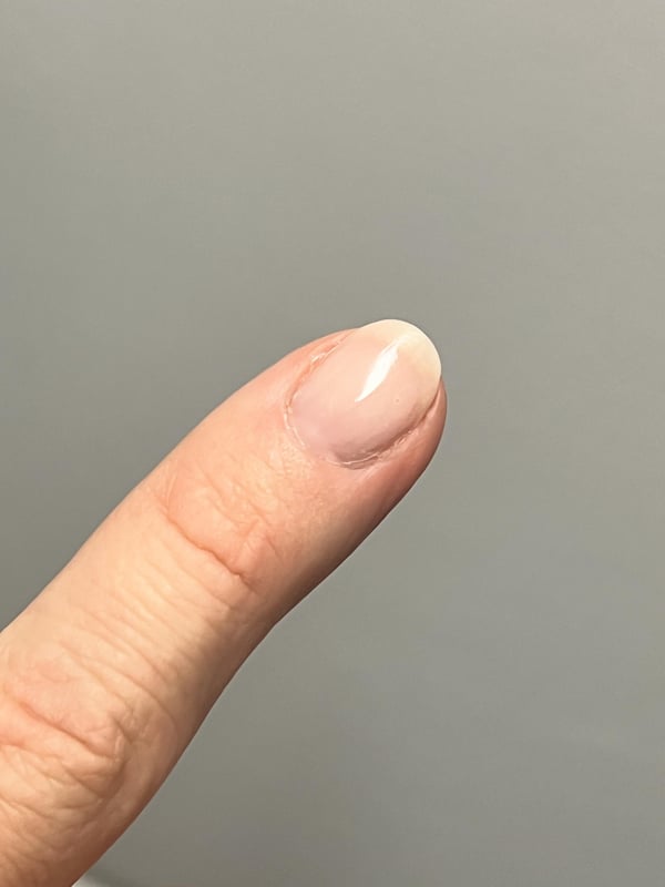 Picture by happyidiottalk_gcu showing '3 Week No-bite-iversary. Why Do I Feel A Sense Of Accomplishment? 😂Also, How Is This Shape For My Stupid Fat Fingers?' number 2