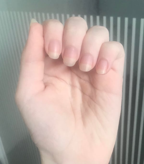 Picture by Daisy_the_blueberry saying '8th Week Update Since I Stopped Nailbiting ❤️'