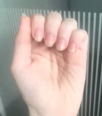 8th Week Update Since I Stopped Nailbiting ❤️