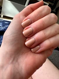 Do My Nails Grow Too Quickly?