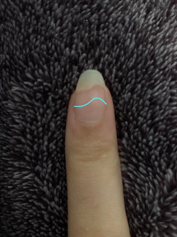 Picture by sweet_lilies saying 'Why Does My Natural Nail white Part Curve Like That?'