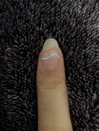 Why Does My Natural Nail white Part Curve Like That?