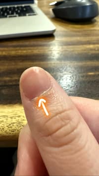 Do I Need To Cut My Cuticle?