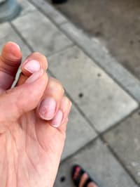 Help! Nail Tech Dug Tool Into Nail