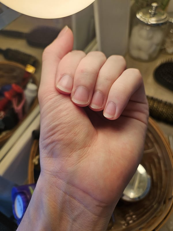 Picture by PassOk2235 saying 'Nail Biter For 8+ Years Throughout Childhood, Quit ~3 Years Ago. Just Clipped And Filed My Nails -- How Did I Do? What Can I Do Better?'