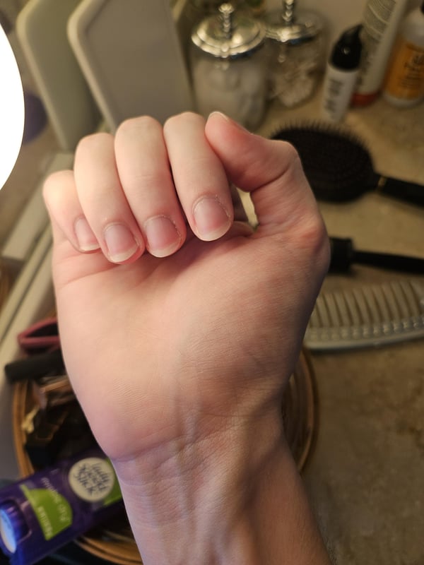 Picture by PassOk2235 showing 'Nail Biter For 8+ Years Throughout Childhood, Quit ~3 Years Ago. Just Clipped And Filed My Nails -- How Did I Do? What Can I Do Better?' number 2