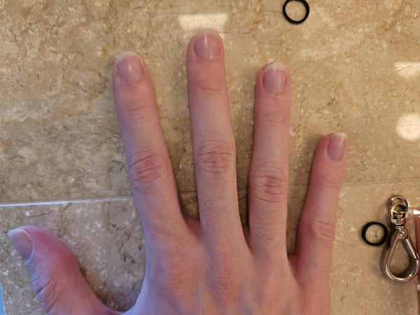 Picture by PassOk2235 showing 'Nail Biter For 8+ Years Throughout Childhood, Quit ~3 Years Ago. Just Clipped And Filed My Nails -- How Did I Do? What Can I Do Better?' number 3