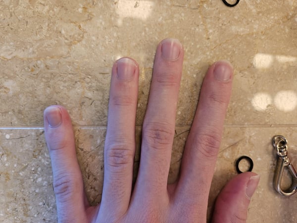 Picture by PassOk2235 showing 'Nail Biter For 8+ Years Throughout Childhood, Quit ~3 Years Ago. Just Clipped And Filed My Nails -- How Did I Do? What Can I Do Better?' number 4