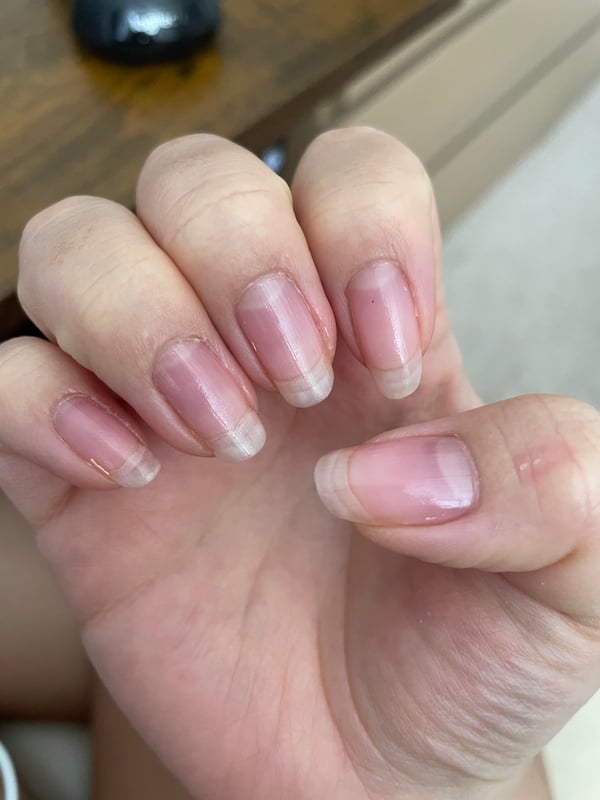 Picture by maryypsb saying 'Horizontal Lines On Nails?'