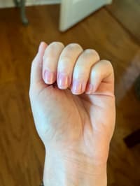 Peeling Nails