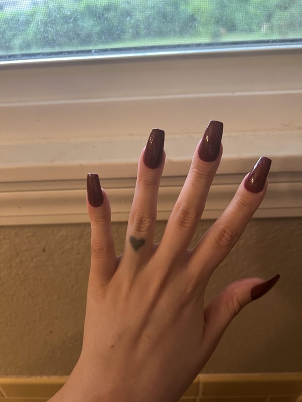 Picture by anonasshole56435788 showing 'My First At-home Acrylics On Clubbed Fingers Since I Still Cannot Stop Biting!' number 1