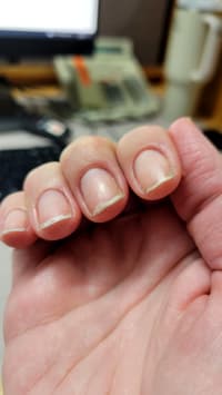 I Don't Know Why My Nails Keep Splitting