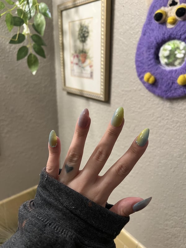 Picture by anonasshole56435788 saying 'More On Nails For Clubbed Fingers!'