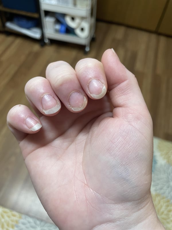 Picture by lisamd91 saying 'Why Does My Nail Do This? Typically It’s My Index And Middle Finger On Both Hands That Curl. Also How Do I Narrow Out My Middle Fingernails? They’re So Wide.'