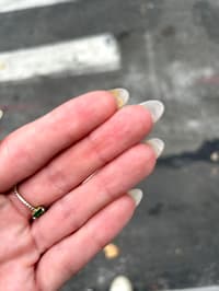 Why Is My Nail So Yellow Under My Tips?