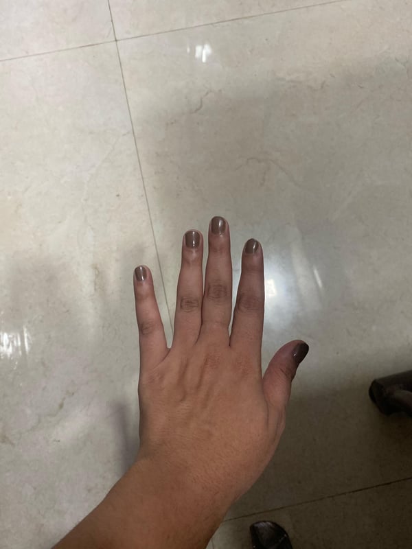 Picture by Background_Tiger_840 saying 'Suggest Nail Shape'