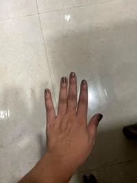 Suggest Nail Shape