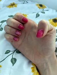 How To Fix My Nails?