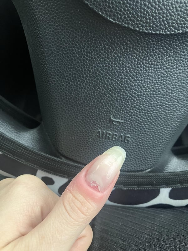 Picture by TudorFamilyProblems showing 'Can Someone Please Explain Why My Nail Stopped Growing At The Nail Bed, I’ve Had No Injury At All?' number 2