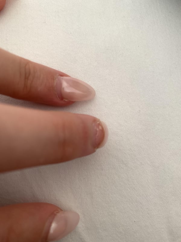 Picture by tomthebodygaurd saying 'Acrylics Breaking From The Bottom And Peeling My Natural Nail Off'