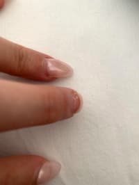 Acrylics Breaking From The Bottom And Peeling My Natural Nail Off