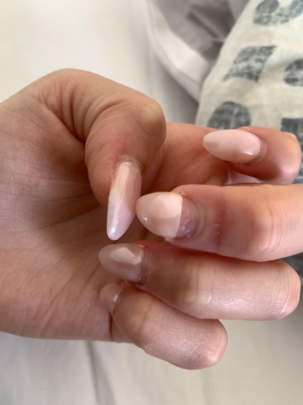 Picture by tomthebodygaurd showing 'Acrylics Breaking From The Bottom And Peeling My Natural Nail Off' number 1