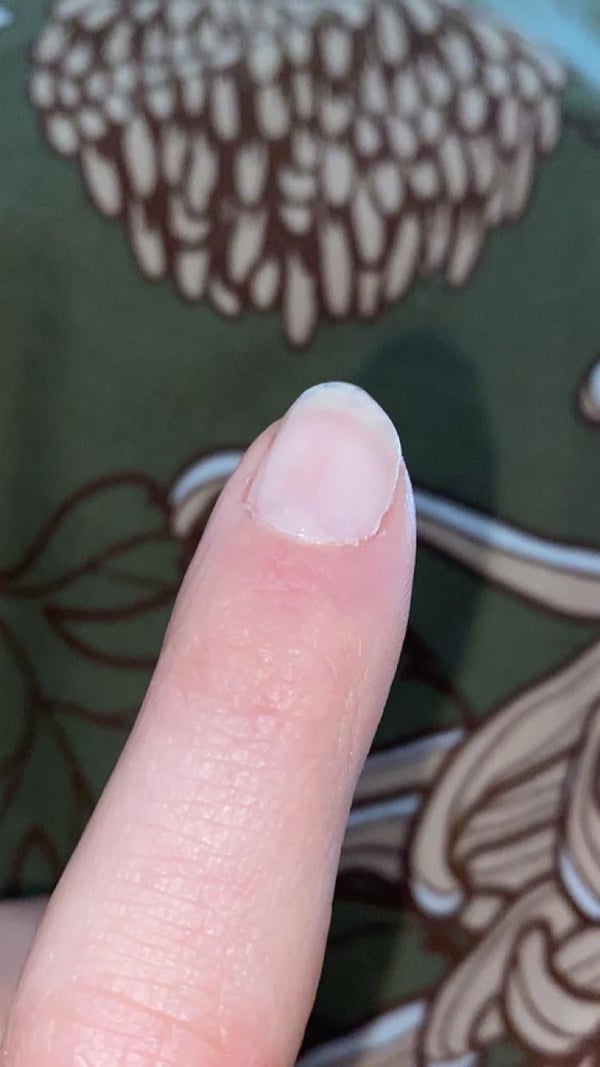 Picture by audexd showing 'Why Does My Nail Polish Lift At The Edges?' number 2