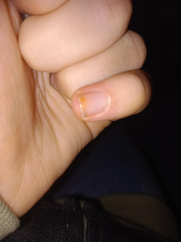 Picture by ShadxwRxses saying 'Yellow Stains On My Pinky Fingers.'