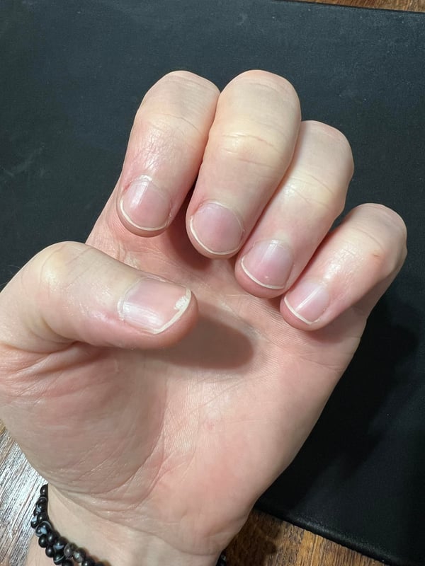 Picture by Future-adult saying 'Looking For Advice About Improving My Cuticles'