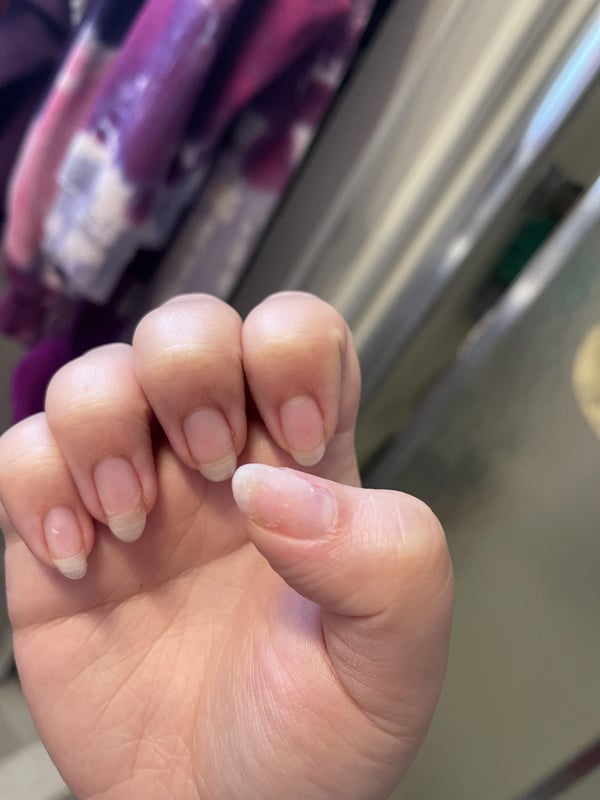 Picture by leelovesgood showing 'Did This Salon Use EMA On Me When I Asked For A Gel Mani??' number 4