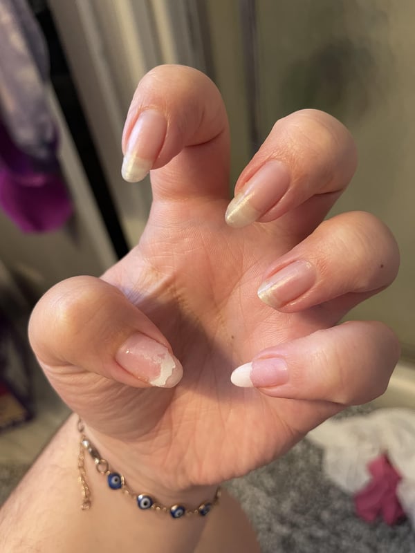 Picture by leelovesgood showing 'Did This Salon Use EMA On Me When I Asked For A Gel Mani??' number 6