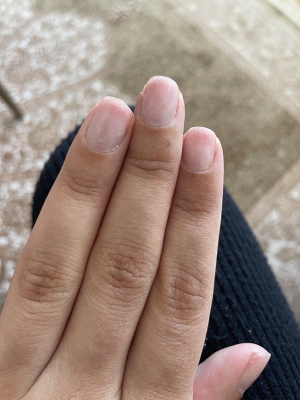 Picture by Difficult-Heart-588 saying 'Nail Technician Used Nail Drill To Take My Gel Off And Took Off So Much Of My Nail Bed, I’m In So Much Pain. Any Suggestions?'