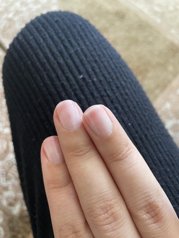 Picture by Difficult-Heart-588 showing 'Nail Technician Used Nail Drill To Take My Gel Off And Took Off So Much Of My Nail Bed, I’m In So Much Pain. Any Suggestions?' number 1